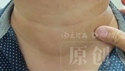 30岁男子患癌后拒绝手术想凭意念消除癌细胞，医生回应
