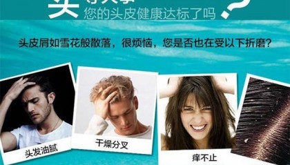 男生用什么洗发水去头屑??无屑社交货币