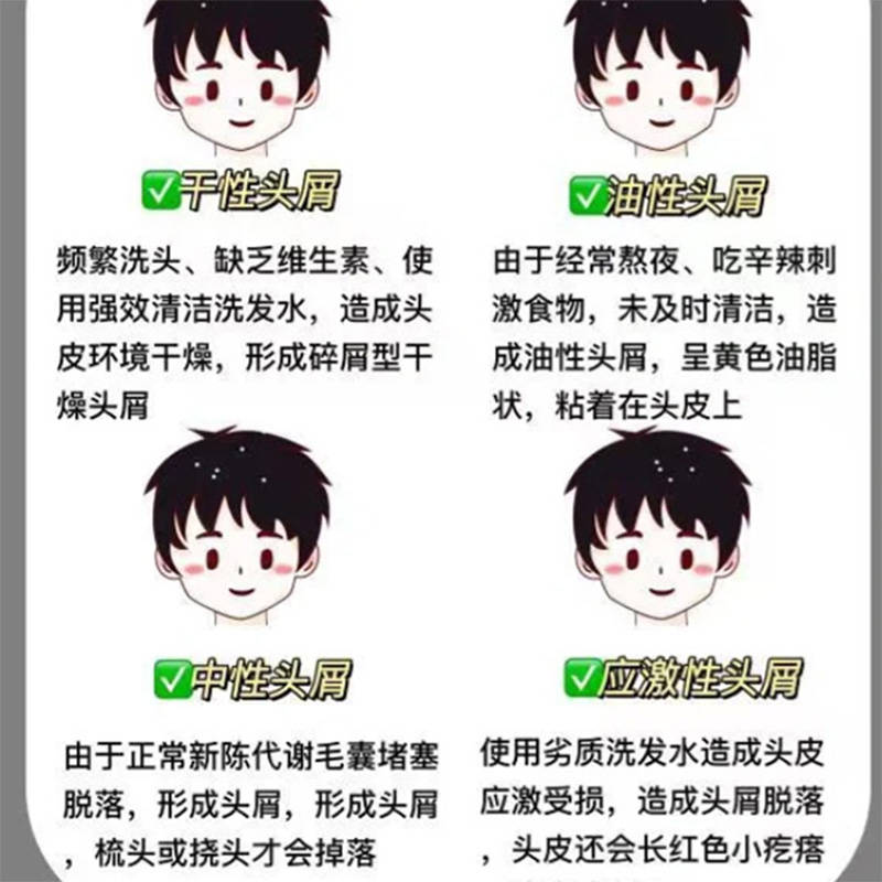 头发少头皮屑多用什么洗发水??无屑社交货币