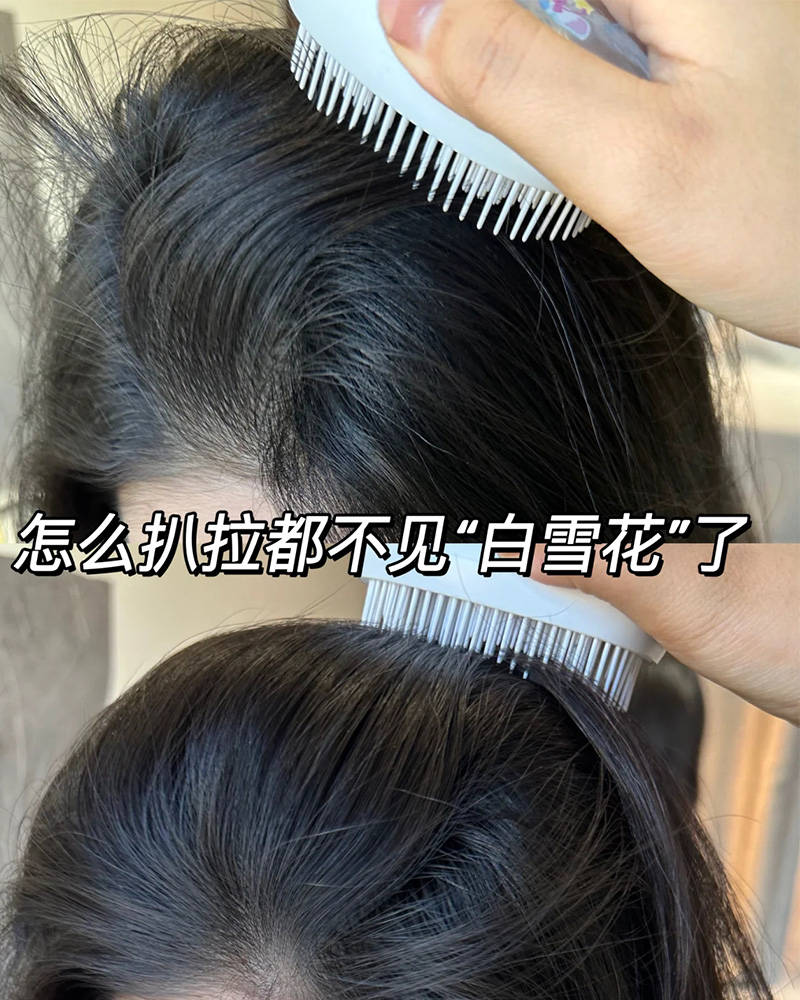 脂溢性头发用什么洗发水??无屑社交货币
