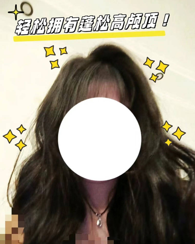 头发油皮屑多用什么洗发水??无屑社交货币