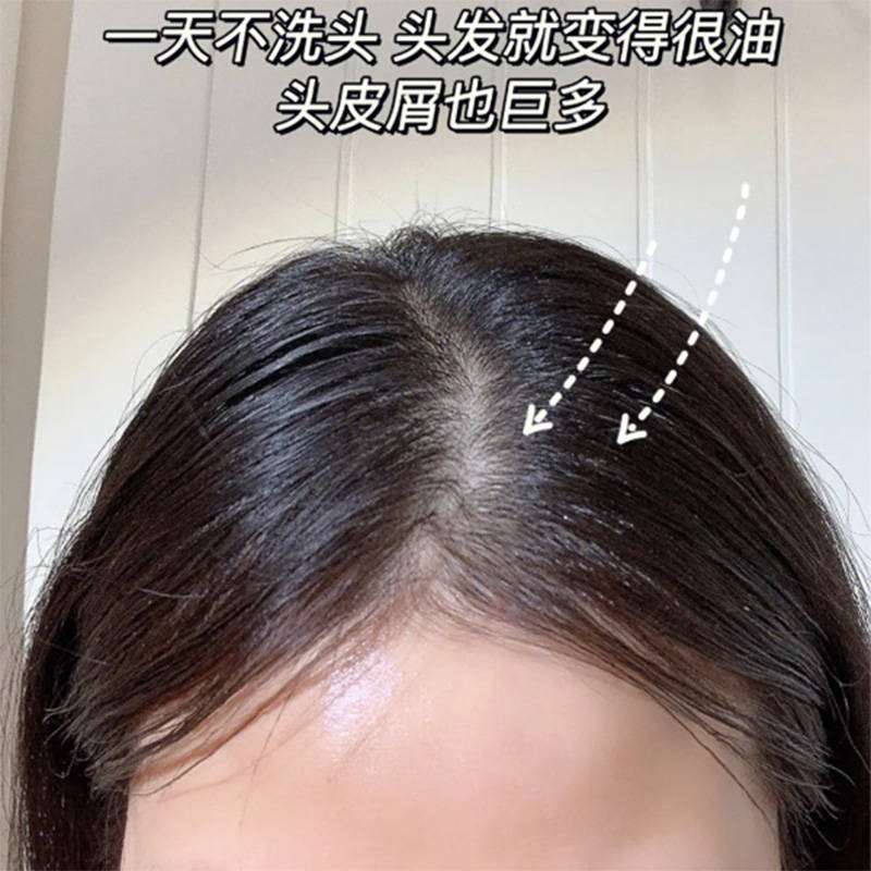 缓解毛囊炎的洗发水是什么牌子的??无屑社交货币